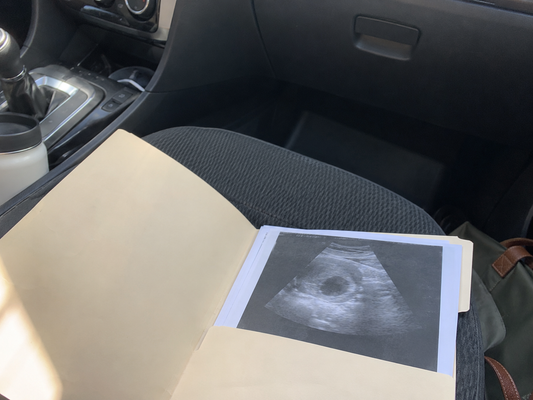 An ultrasound printout resting on a car passenger seat